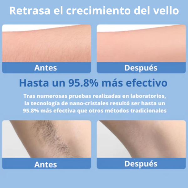 Depiladora PureSkin + Ebook Secretos Depilación Perfecta ¡Gratis hoy!
