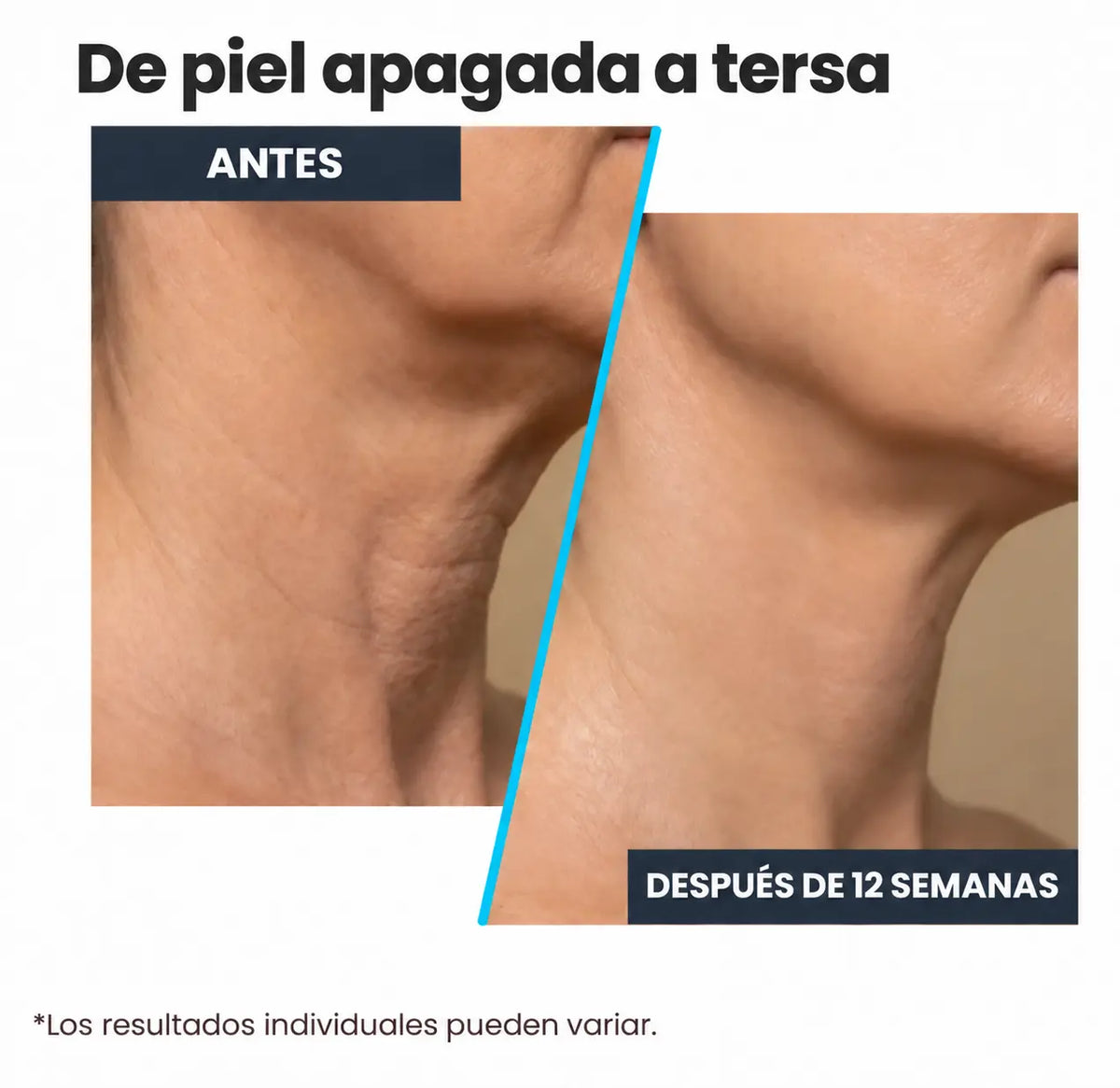 Crema Reafirmante Multiacción - Todo en 1