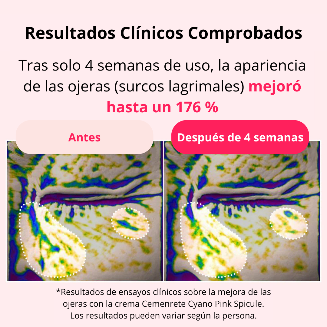 Crema de Espículas Rosa Ciano