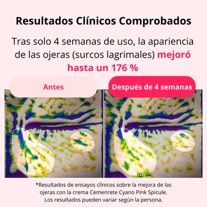 Crema de Espículas Rosa Ciano